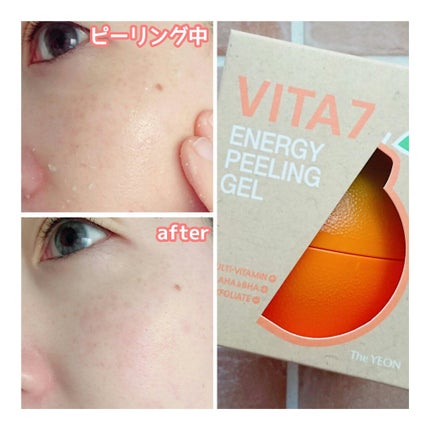 vita7 Energy Peeling Gel/the YEON/ピーリングを使ったクチコミ(6枚目)