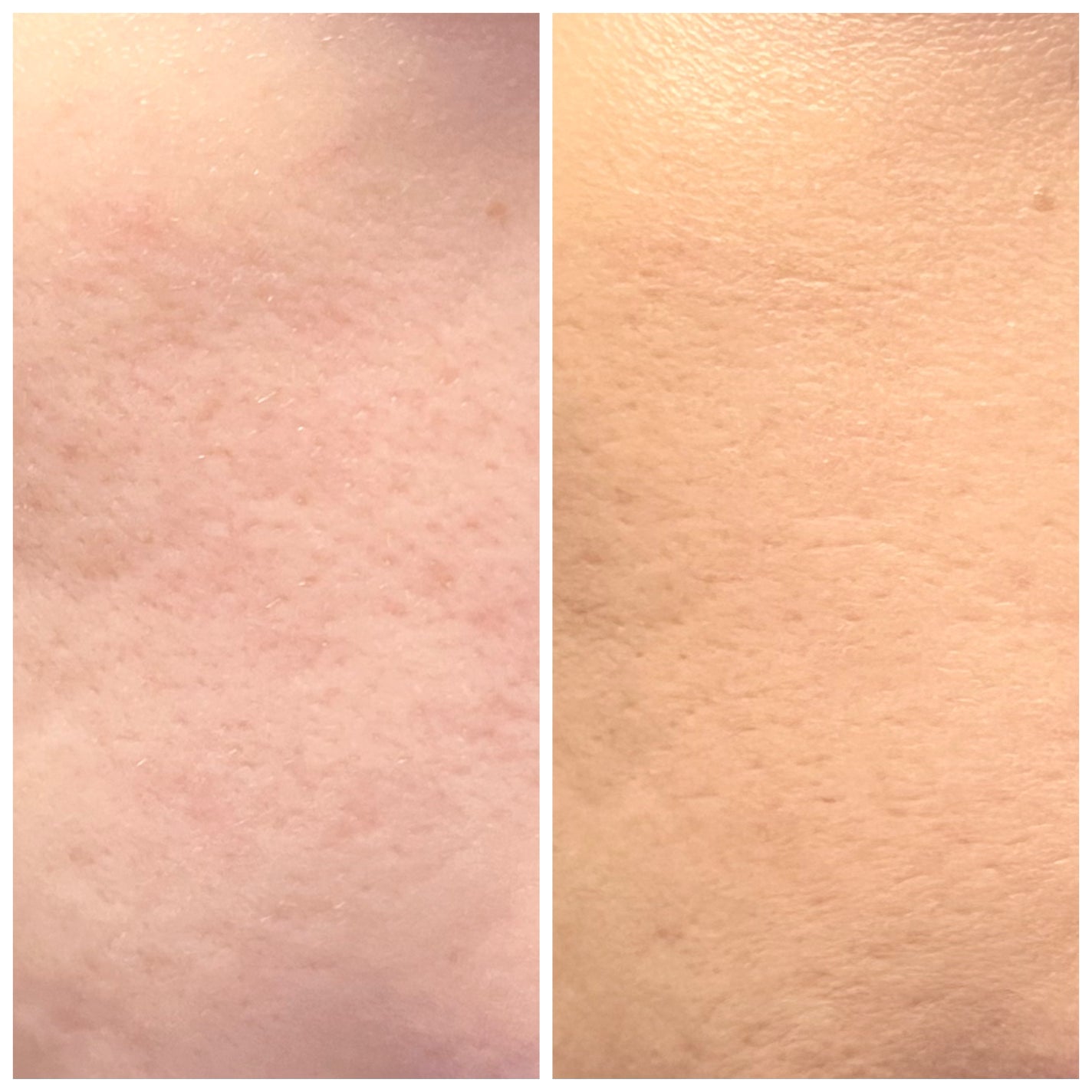 ピンクティーツリーカバーアップグロウクッション/APLIN/クッションファンデーションを使ったクチコミ(5枚目)