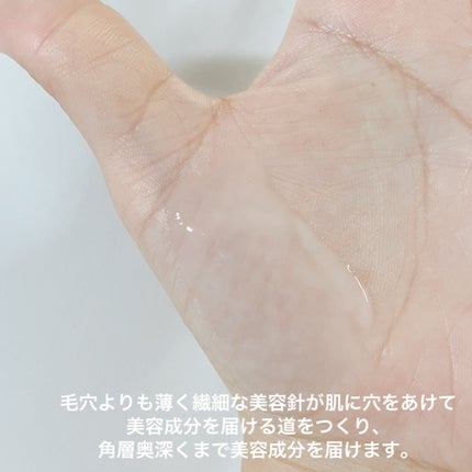 リードルショット100/VT/美容液を使ったクチコミ(4枚目)