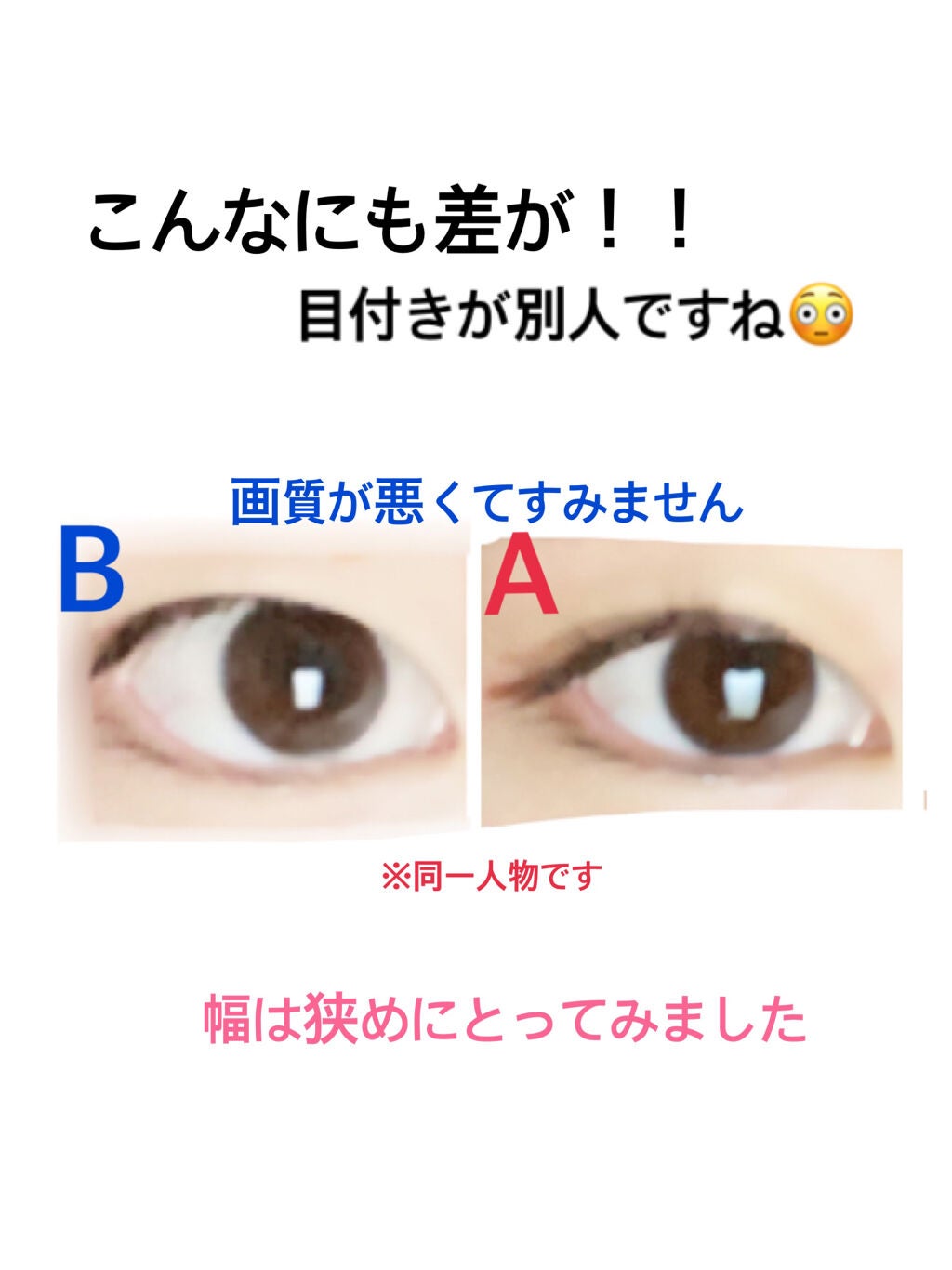 ãªãªã·ã ã¢ã€ãªããã¹ãã³ãã£ã«ã /D-UP/äºéãŸã¶ãçšã¢ã€ãã ã䜿ã£ãã¯ãã³ãïŒ2æç®ïŒ