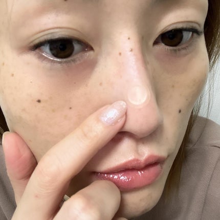 エーキュアショットスポットパッチ/obsero/にきびパッチを使ったクチコミ(6枚目)