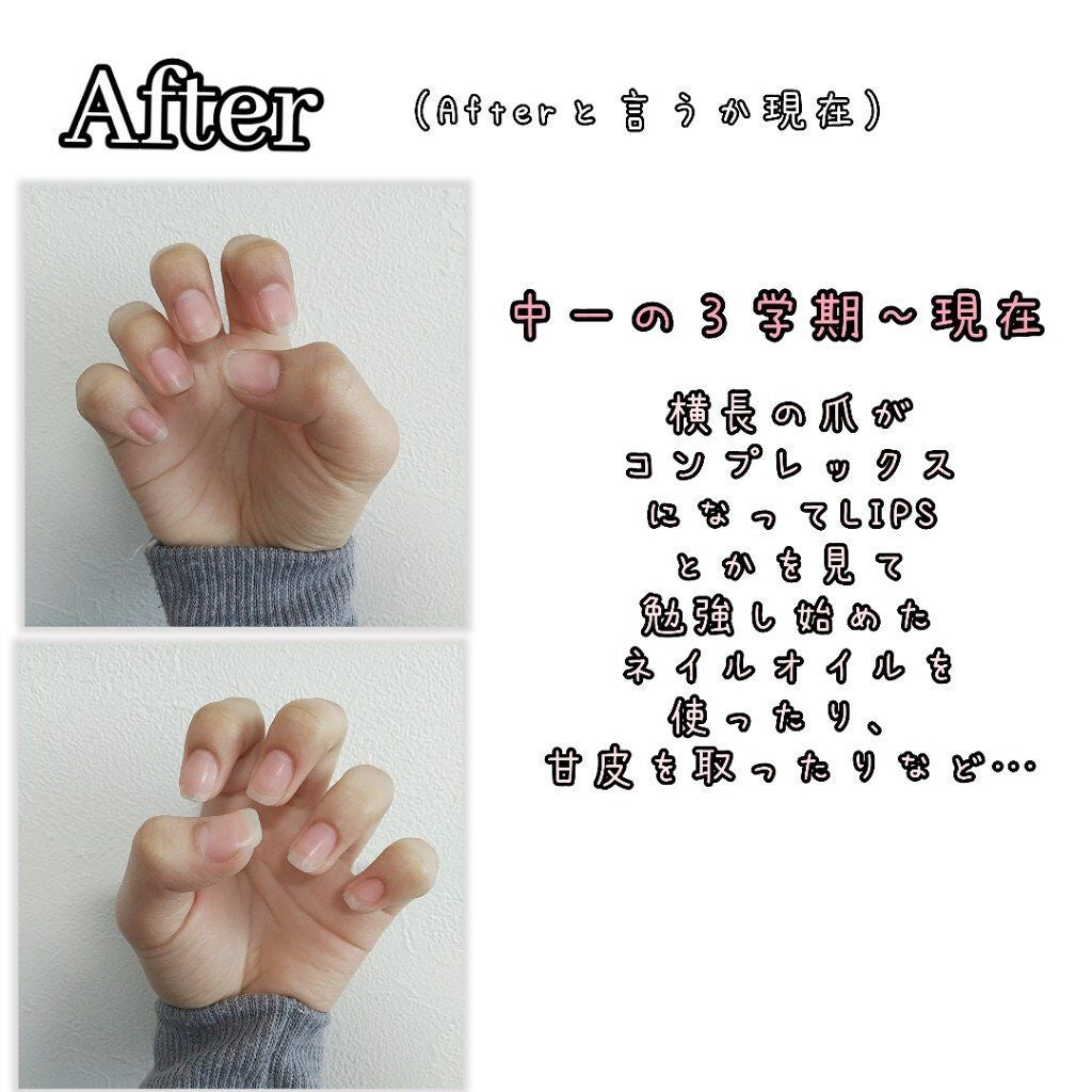 ウィンマックス キューティクルオイル/DAISO/ネイルオイル・トリートメントを使ったクチコミ(3枚目)