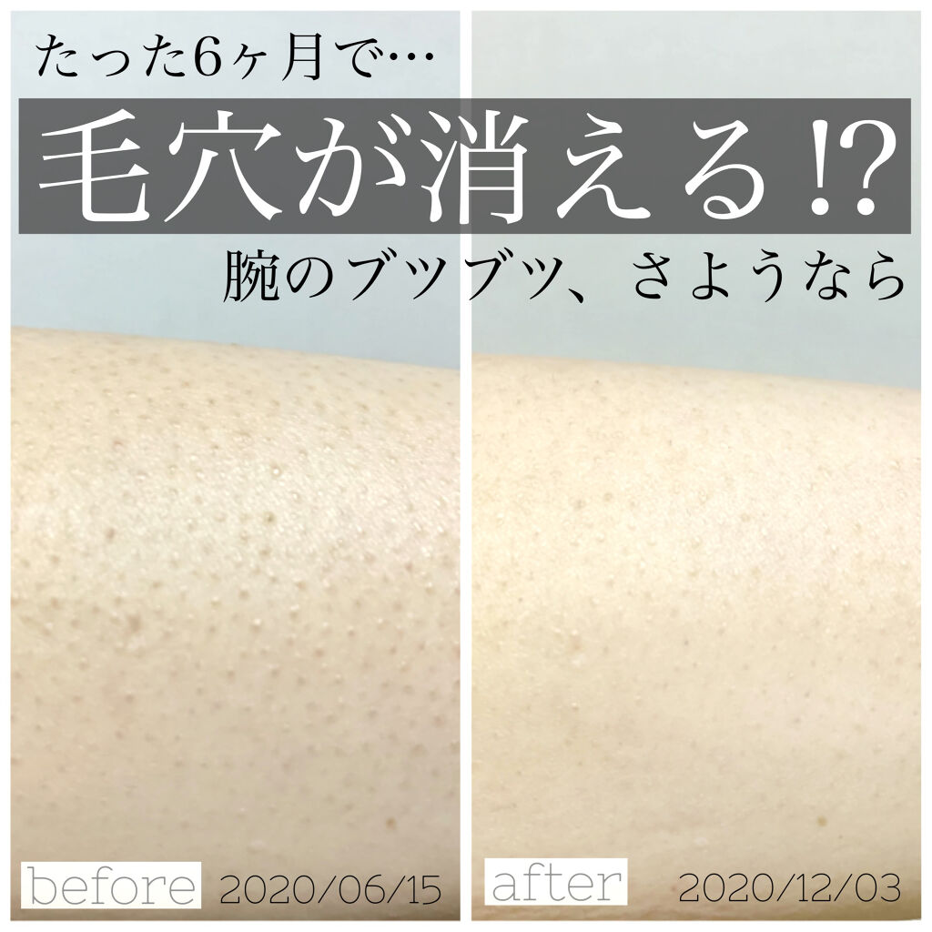 メディカルクリームG（薬用クリームG）/メンターム/ハンドクリームを使ったクチコミ（1枚目）