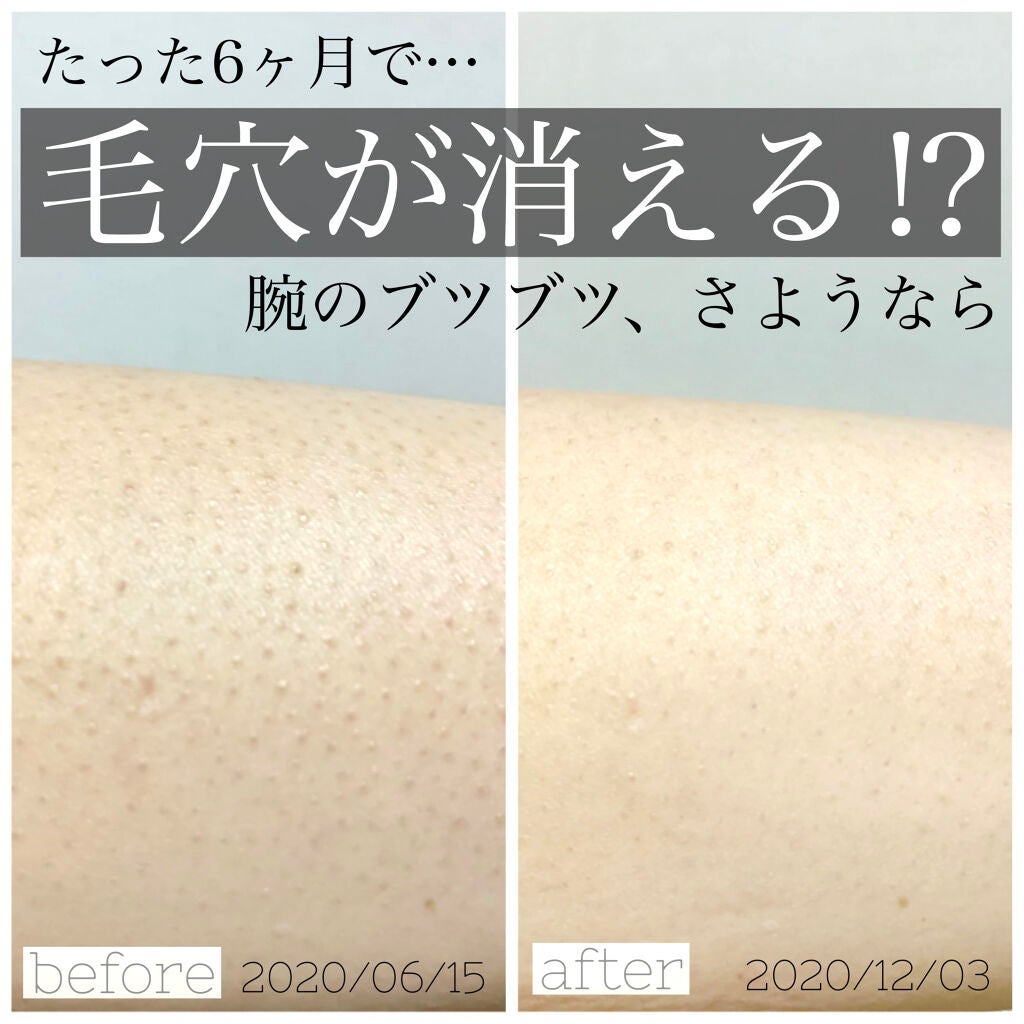 メディカルクリームG(薬用クリームG)/メンターム/ハンドクリームを使ったクチコミ(1枚目)