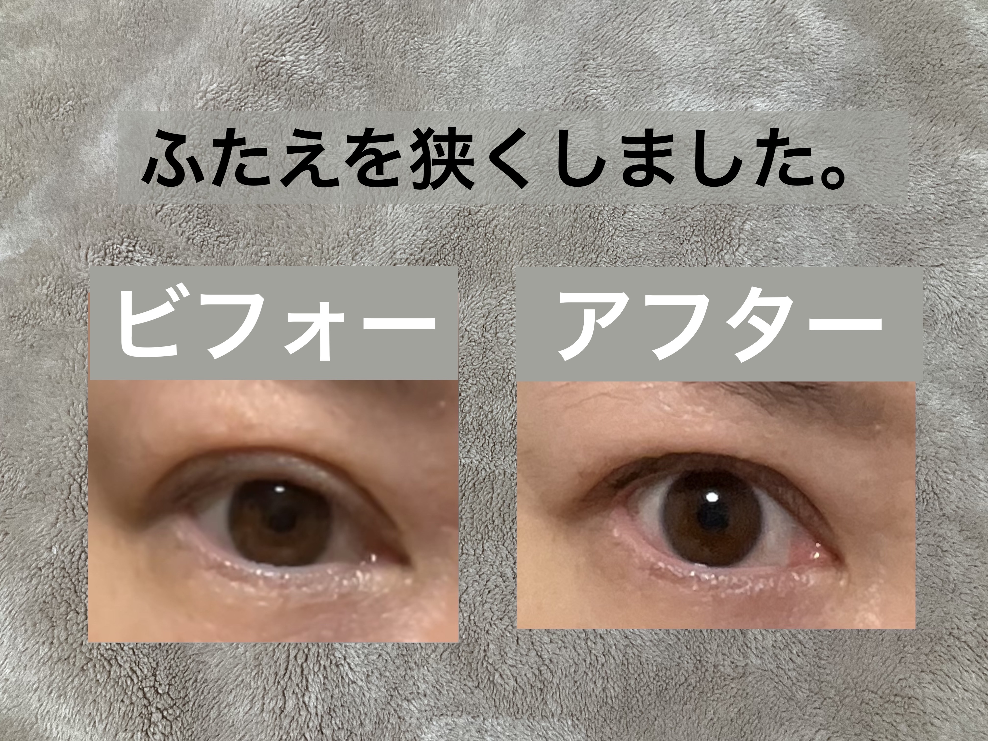 TWOOL ダブルアイリッドグルー/SHOBIDO/二重まぶた用アイテムを使ったクチコミ（2枚目）
