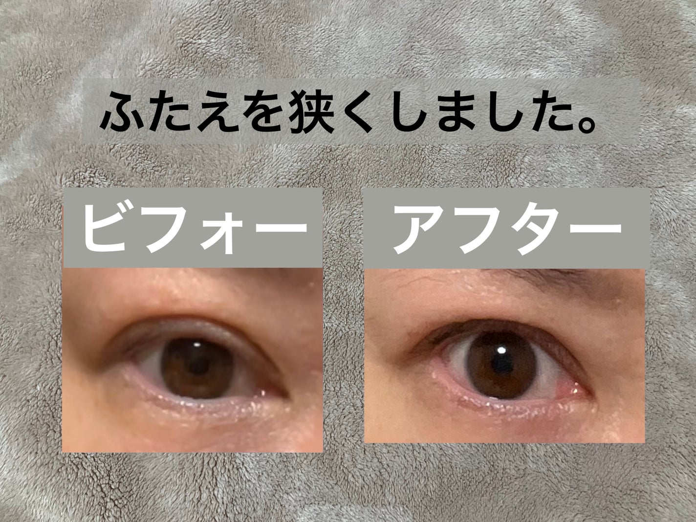 TWOOL ダブルアイリッドグルー/SHOBIDO/二重まぶた用アイテムを使ったクチコミ(2枚目)