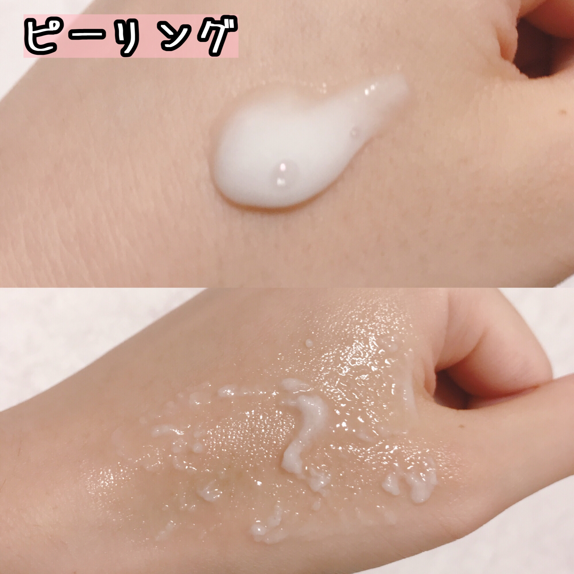 ブライトニングピーリングジェル/Dr.G/ピーリングを使ったクチコミ（2枚目）