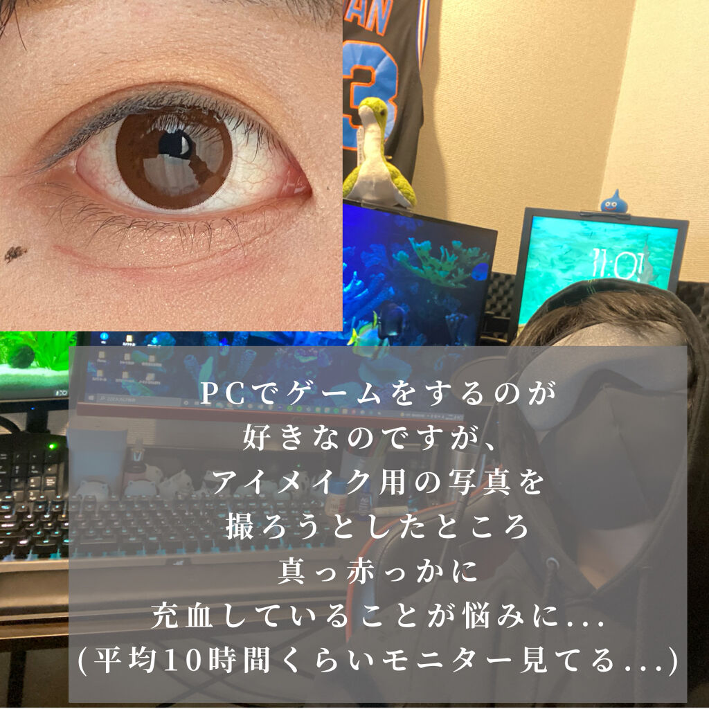 You&Me ホットアイマスク/YOU&ME/ホットアイマスクを使ったクチコミ（2枚目）