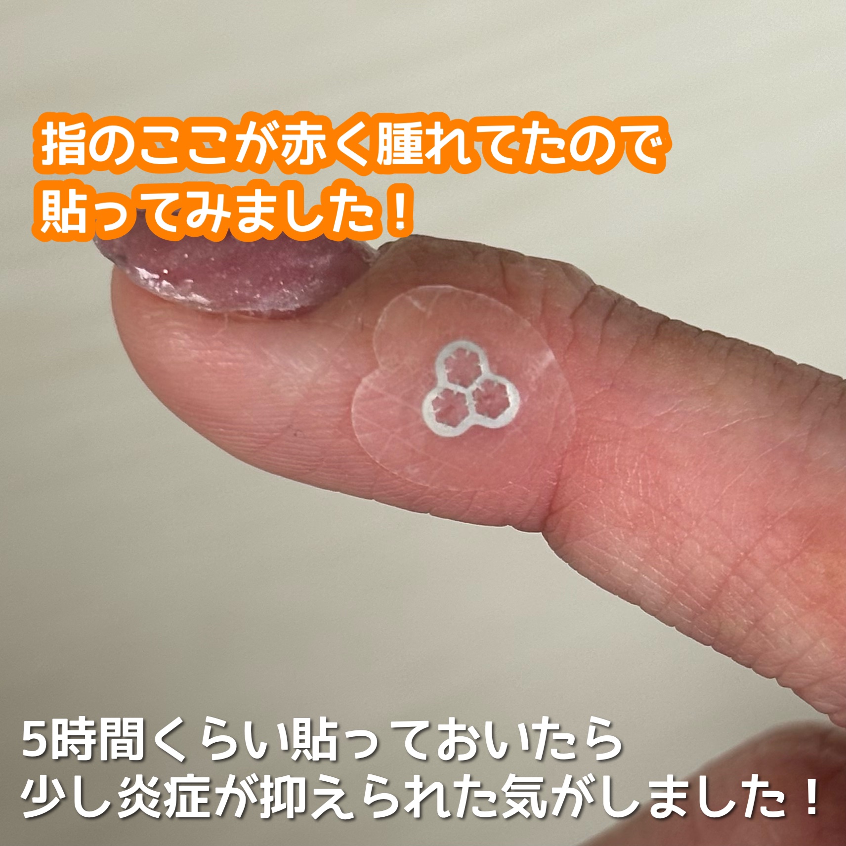 ACマグネシウムパッチ　ミニ/スノーツープラス/にきびパッチを使ったクチコミ（3枚目）