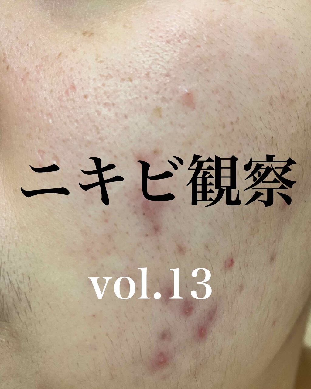 敏感肌用薬用美白美容液/無印良品/美容液を使ったクチコミ（1枚目）