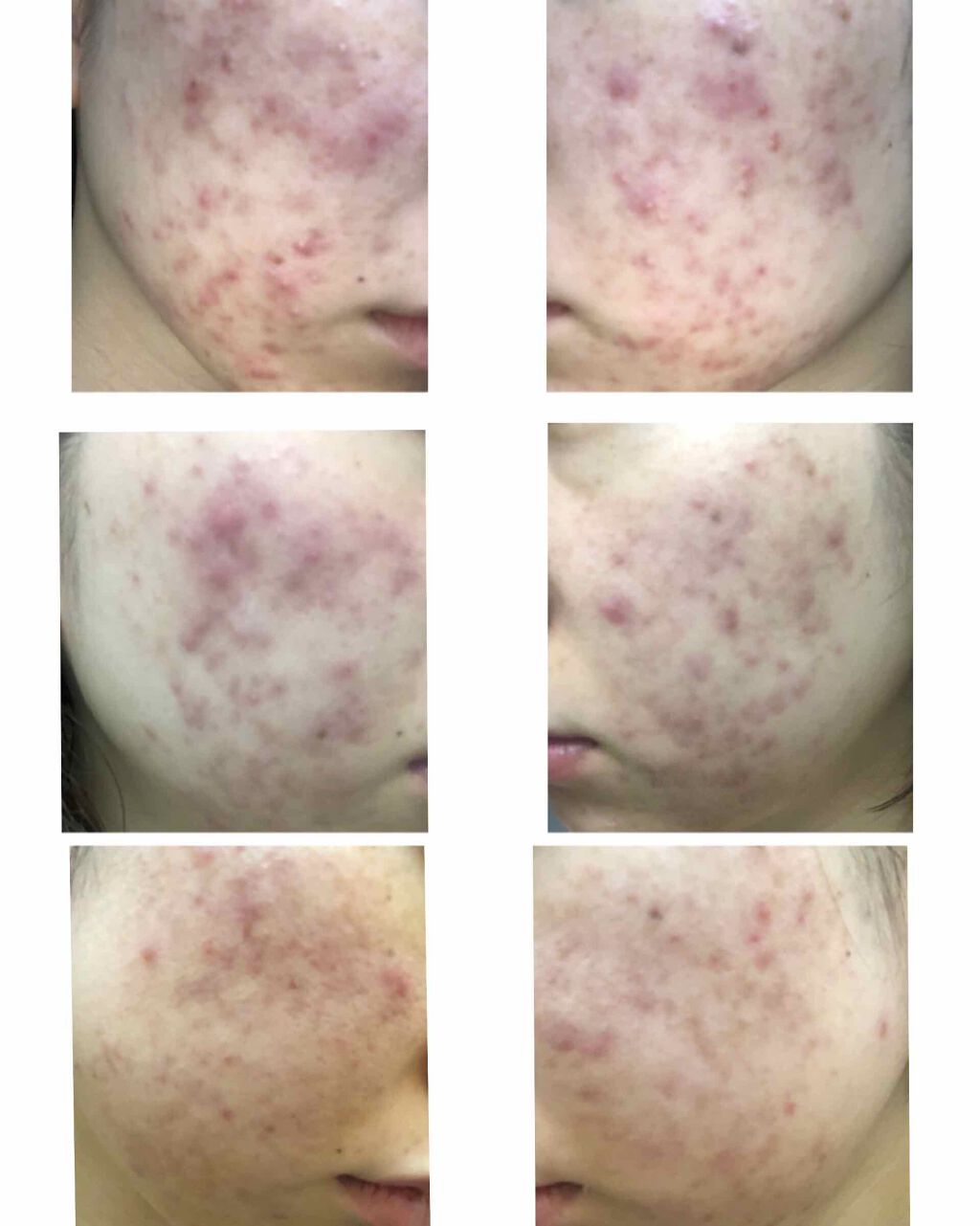 赤箱 (しっとり)/カウブランド/洗顔石鹸を使ったクチコミ(3枚目)