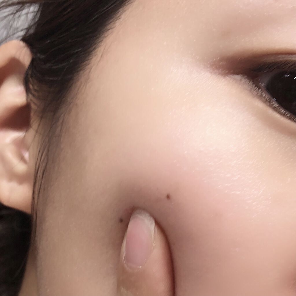 トライアルセット/デルメッド/トライアルキットを使ったクチコミ（3枚目）