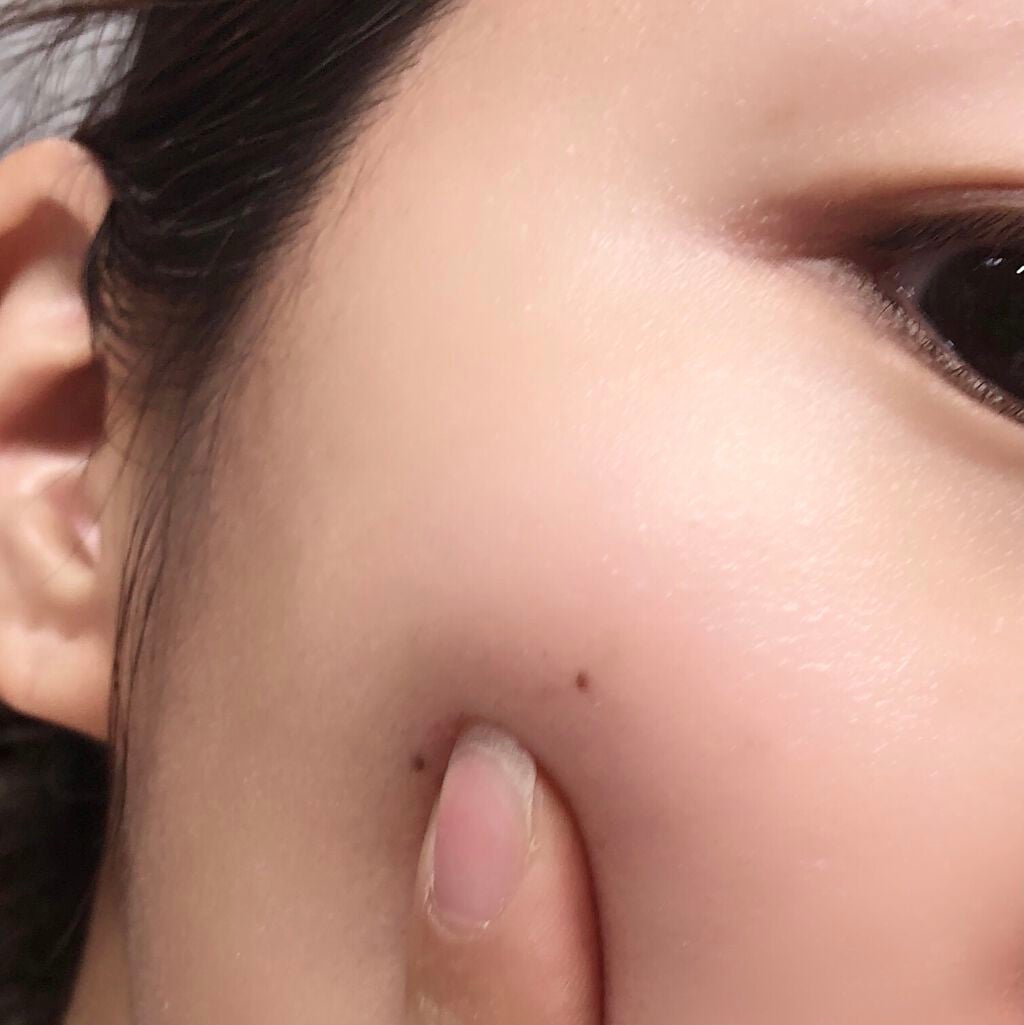 トライアルセット/デルメッド/トライアルキットを使ったクチコミ(3枚目)