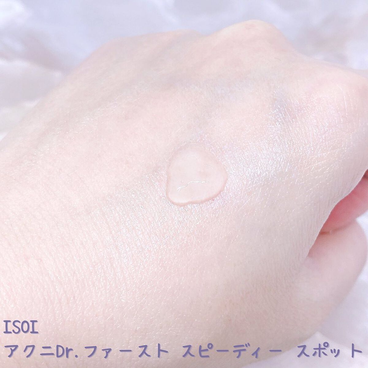アクニドクターファーストスピーディースポット/ISOI/美容液を使ったクチコミ(2枚目)