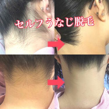 シルクエキスパート ブラウンの口コミ 自宅でセルフうなじ脱毛 うなじって意外と自 By Momo 混合肌 代前半 Lips