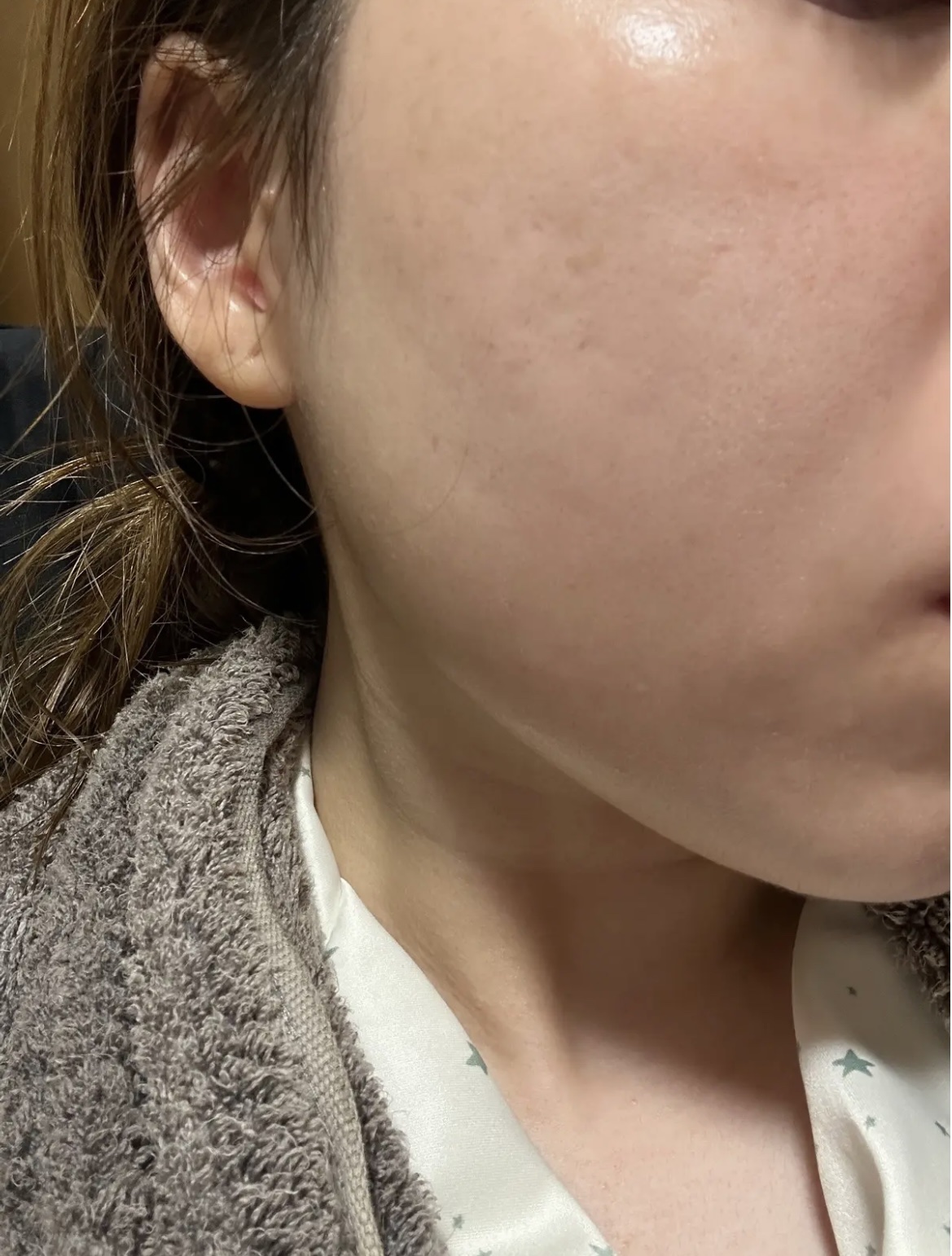  ビタプル リペア エッセンスローション/VITAPURU/化粧水を使ったクチコミ（1枚目）