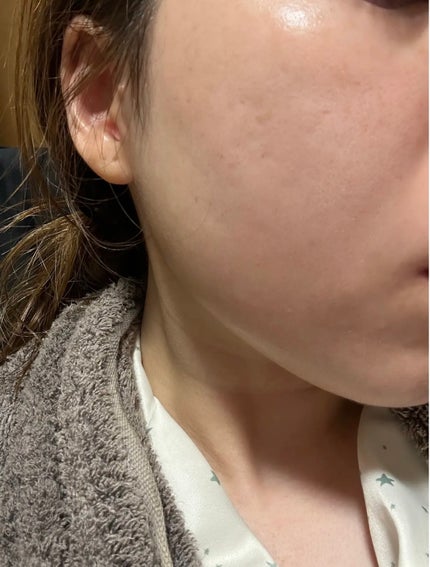 ビタプル リペアアクアリージェルクリーム/VITAPURU/フェイスクリームを使ったクチコミ(1枚目)