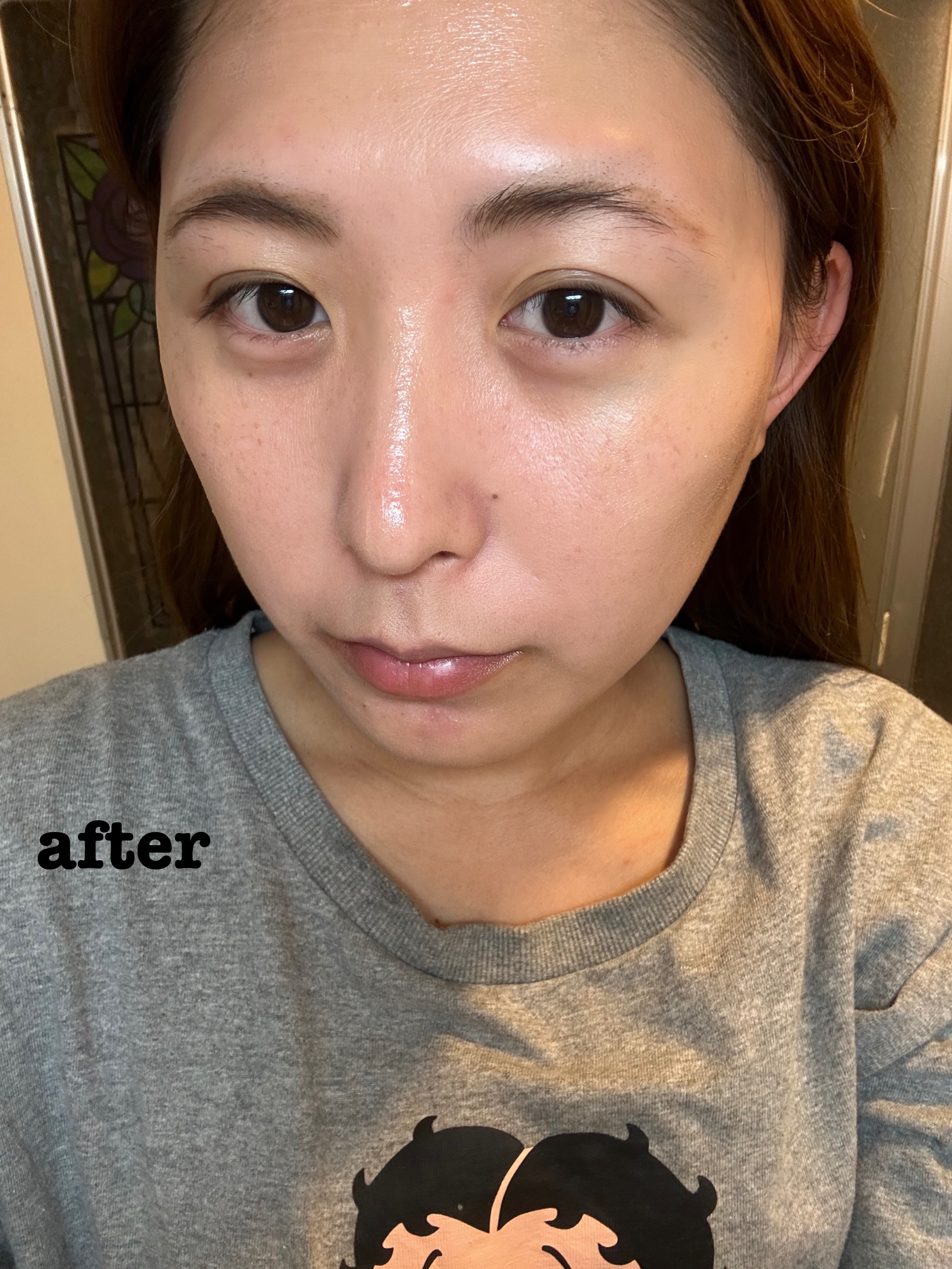 コラーゲンモイスチャーコアスティック/illuN/美容液を使ったクチコミ（3枚目）