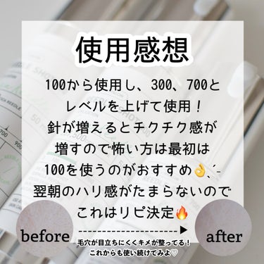 リードルショット100/VT/美容液を使ったクチコミ（6枚目）