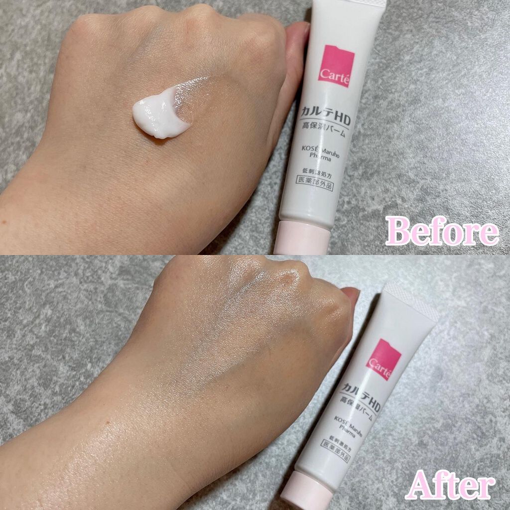 モイスチュア バーム/カルテHD/フェイスバームを使ったクチコミ(2枚目)