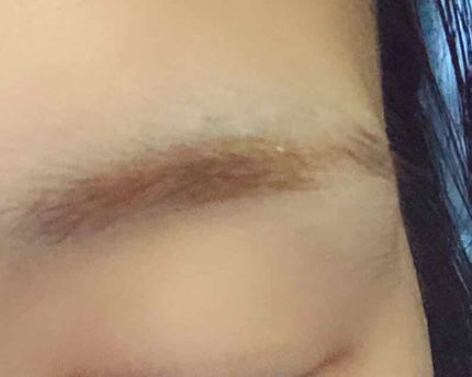 脱色クリーム スピーディー/エピラット/ムダ毛ケアを使ったクチコミ(4枚目)