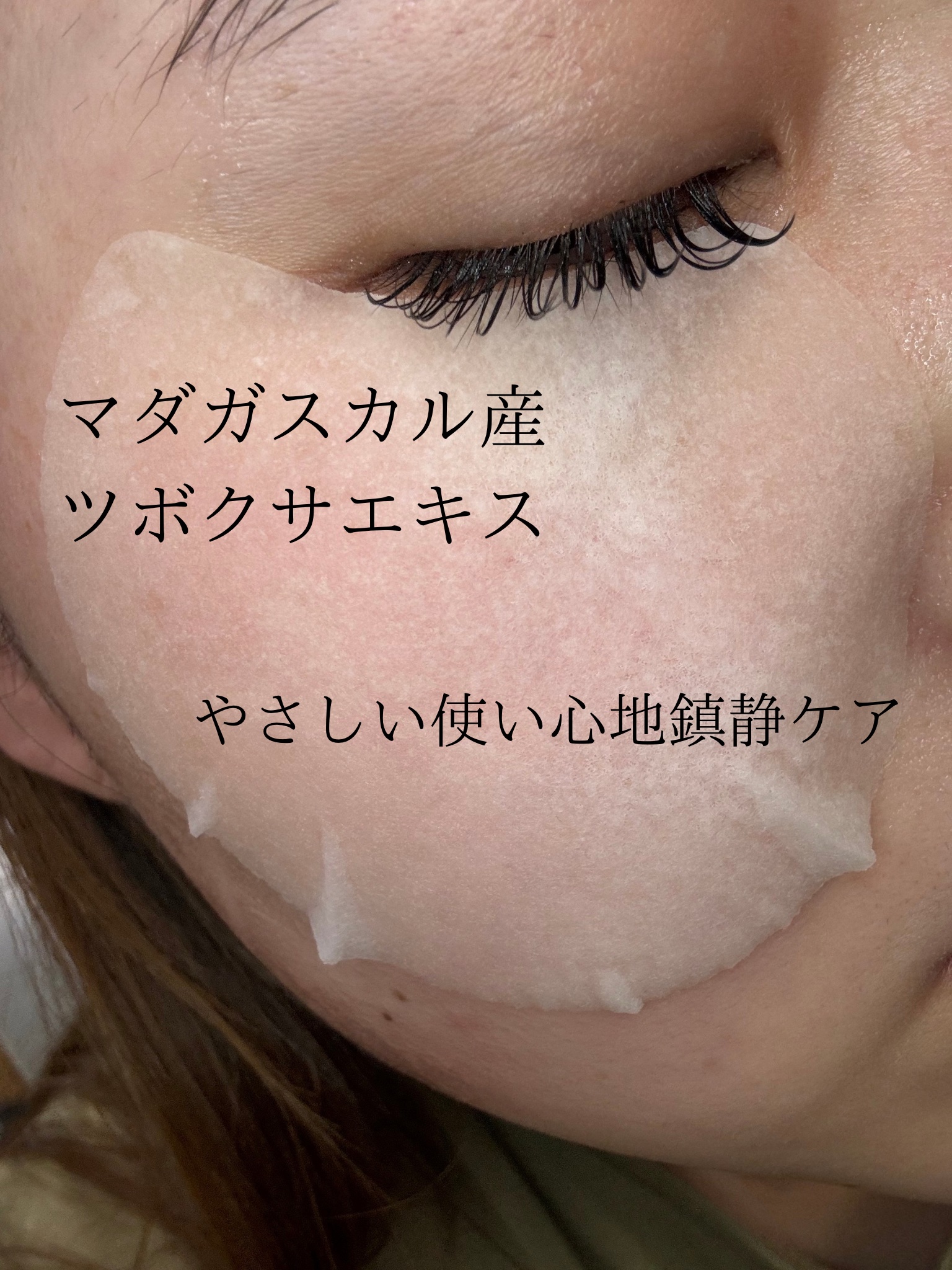 センテラ クイックカーミングパッド/SKIN1004/トナーパッドを使ったクチコミ（3枚目）