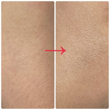 ザビタミンC23/IOPE/美容液を使ったクチコミ(4枚目)