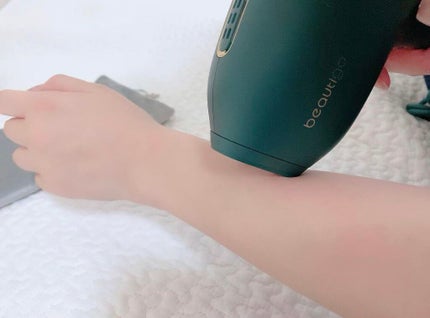 サファイアIPL脱毛器 /yete/家庭用脱毛器を使ったクチコミ(2枚目)