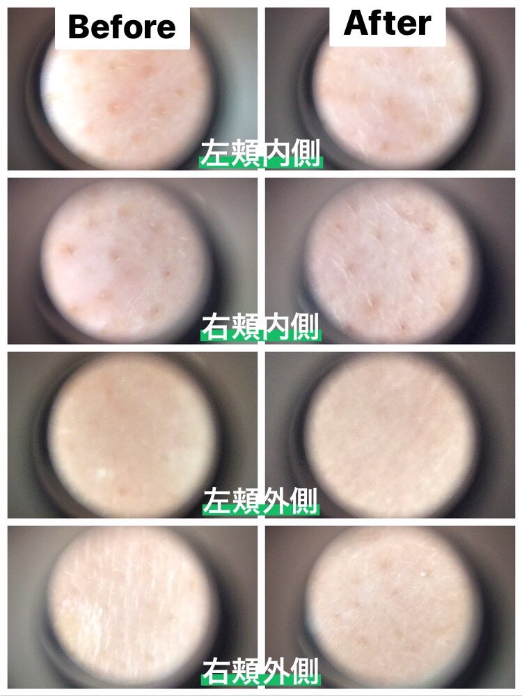 シカレチA エッセンス0.1/VT/美容液を使ったクチコミ(3枚目)