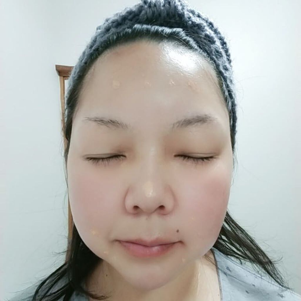 ウルセラタンリフト｜スマスリフトの口コミ - 【ファンデで引き締め