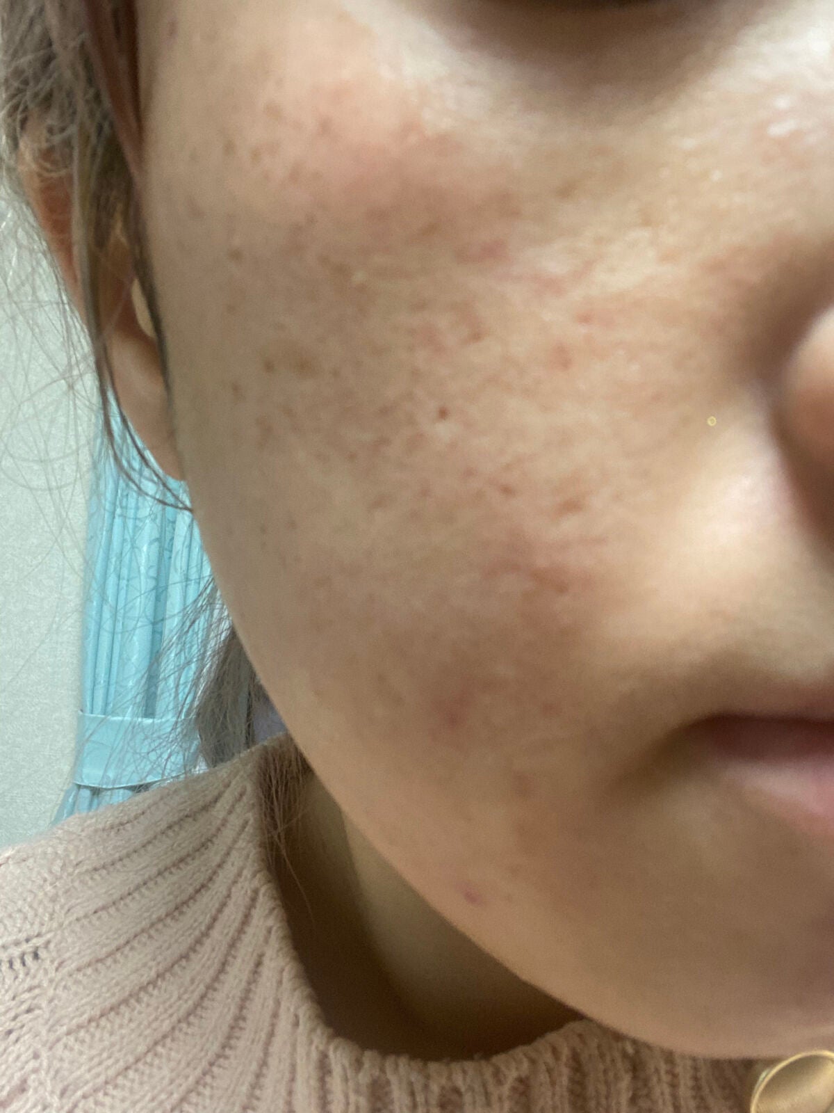 レチノールA 1% アドバンスドリバイタリゼーションクリーム/Life-flo/フェイスクリームを使ったクチコミ(1枚目)