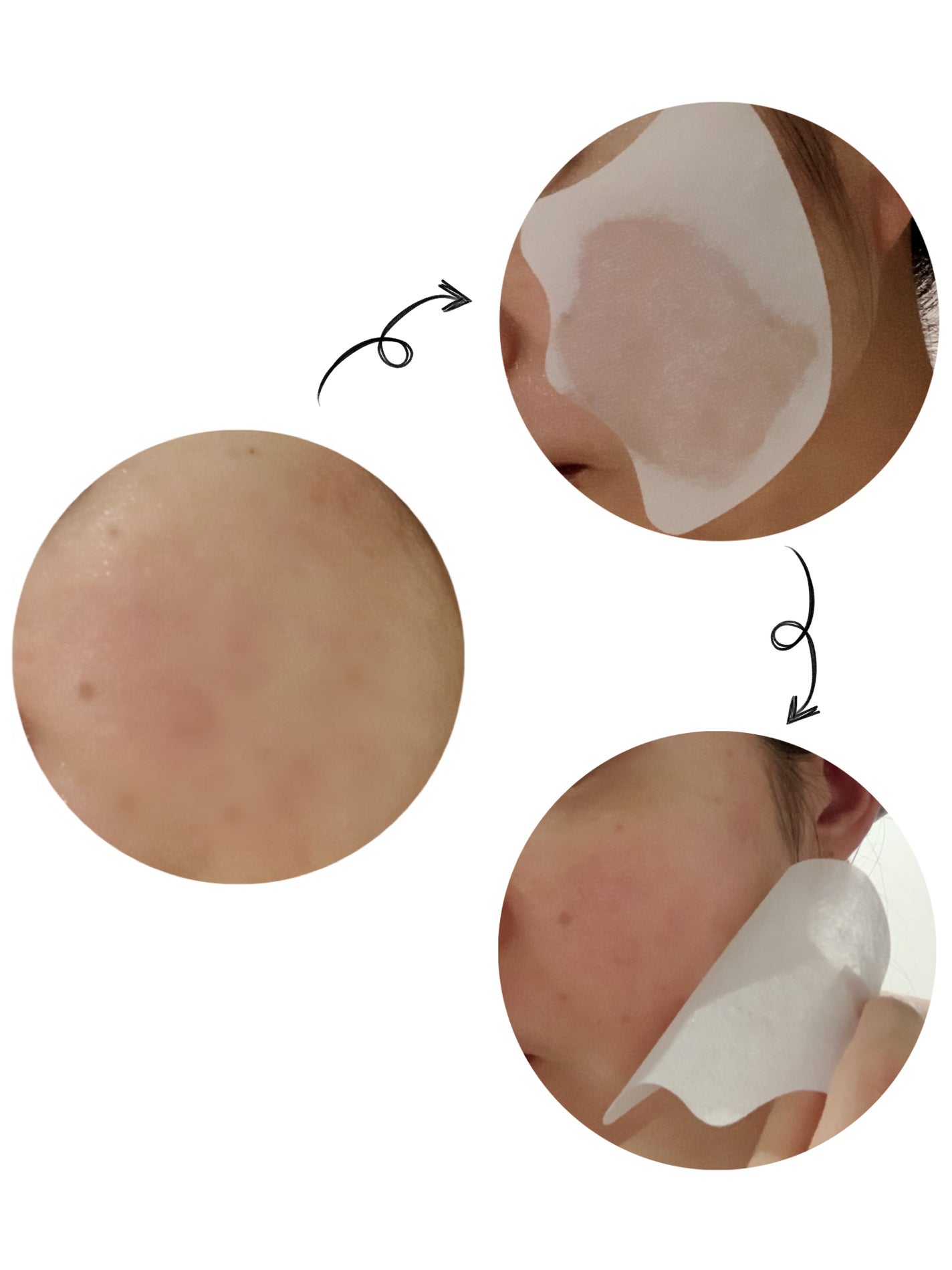 Derma Lift Mask/ALLUDEM/スキンケアキットを使ったクチコミ(7枚目)