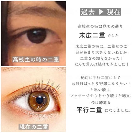 アイテープ(絆創膏タイプ、レギュラー、70枚)/DAISO/二重まぶた用アイテムを使ったクチコミ(2枚目)