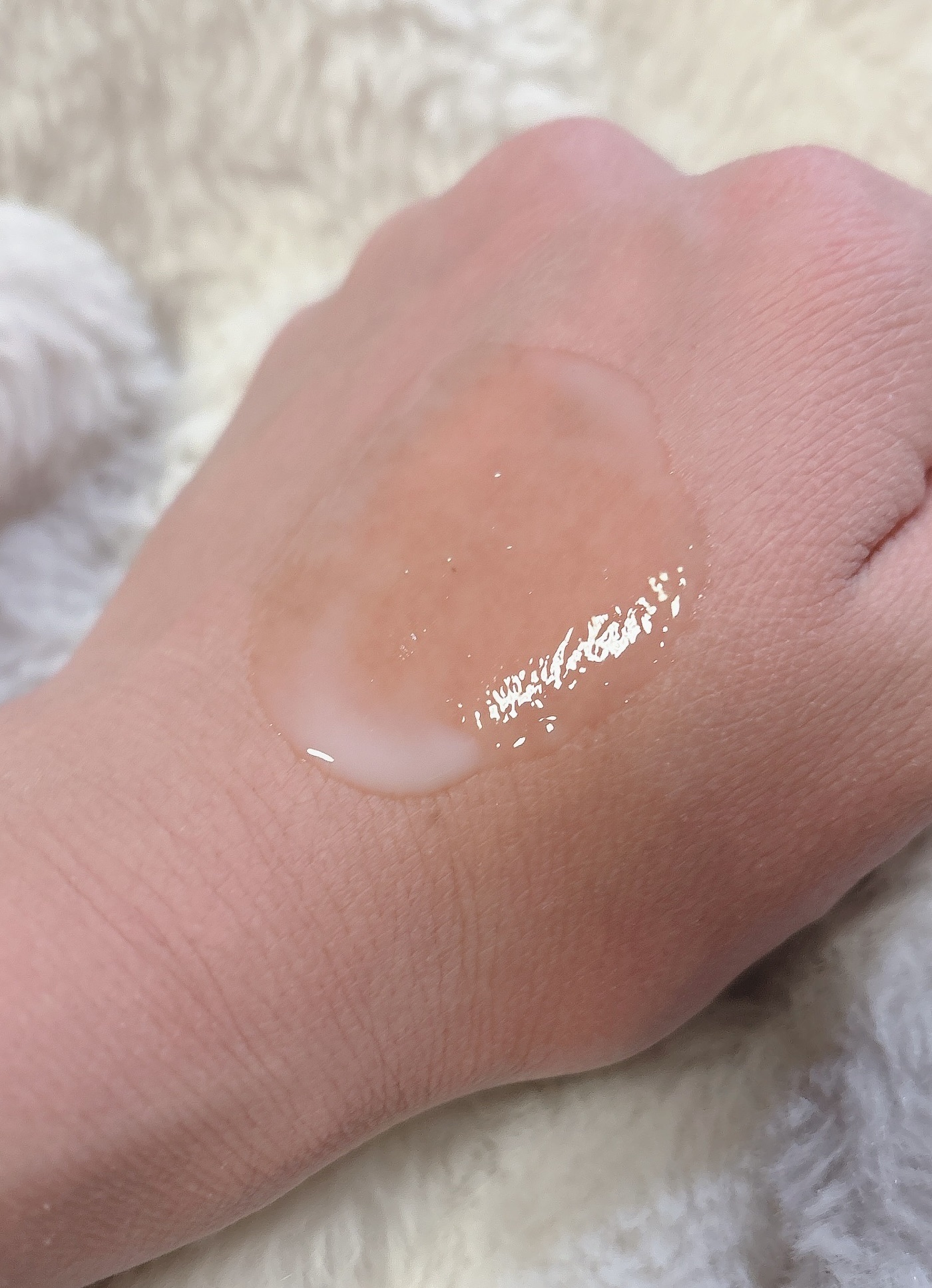 プロバイオシカ インテンシブ アンプル/SKIN1004/美容液を使ったクチコミ（3枚目）