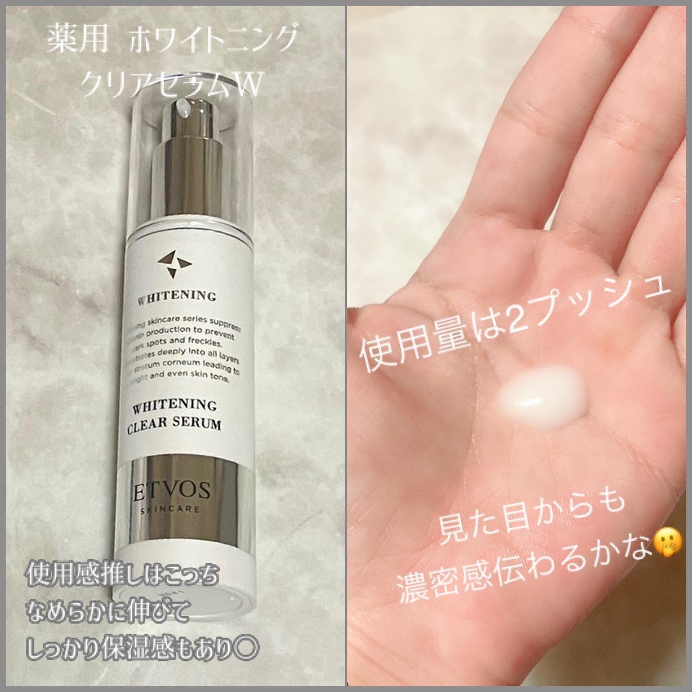 ããŒã¿ãððãã©ãã100 on LIPS ãâ©.*ËETVOSã®ããã¢ãŒã·ã§ã³ã«åå äžã§ãâ©.*Ëããã¯ã..ãïŒ5æç®ïŒ