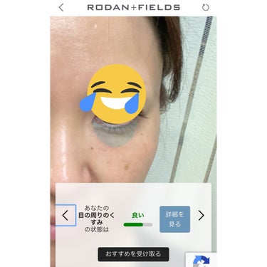 Myuu on LIPS 「Rodan＋Fieldsソリューションツール✨簡単な質問に答え..」（3枚目）