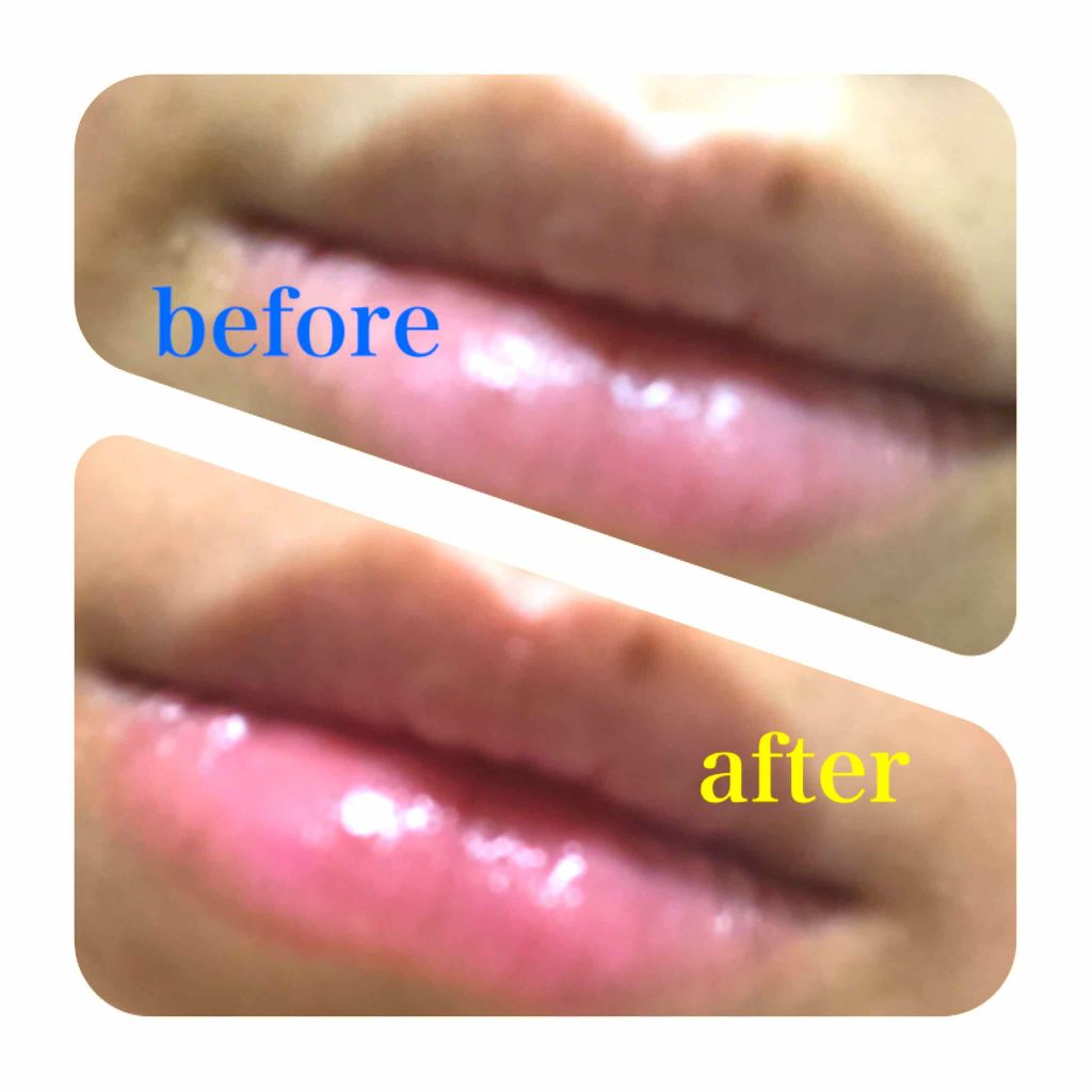 リップケアティント クリア［ミッキー］/DHC/リップクリームを使ったクチコミ（2枚目）