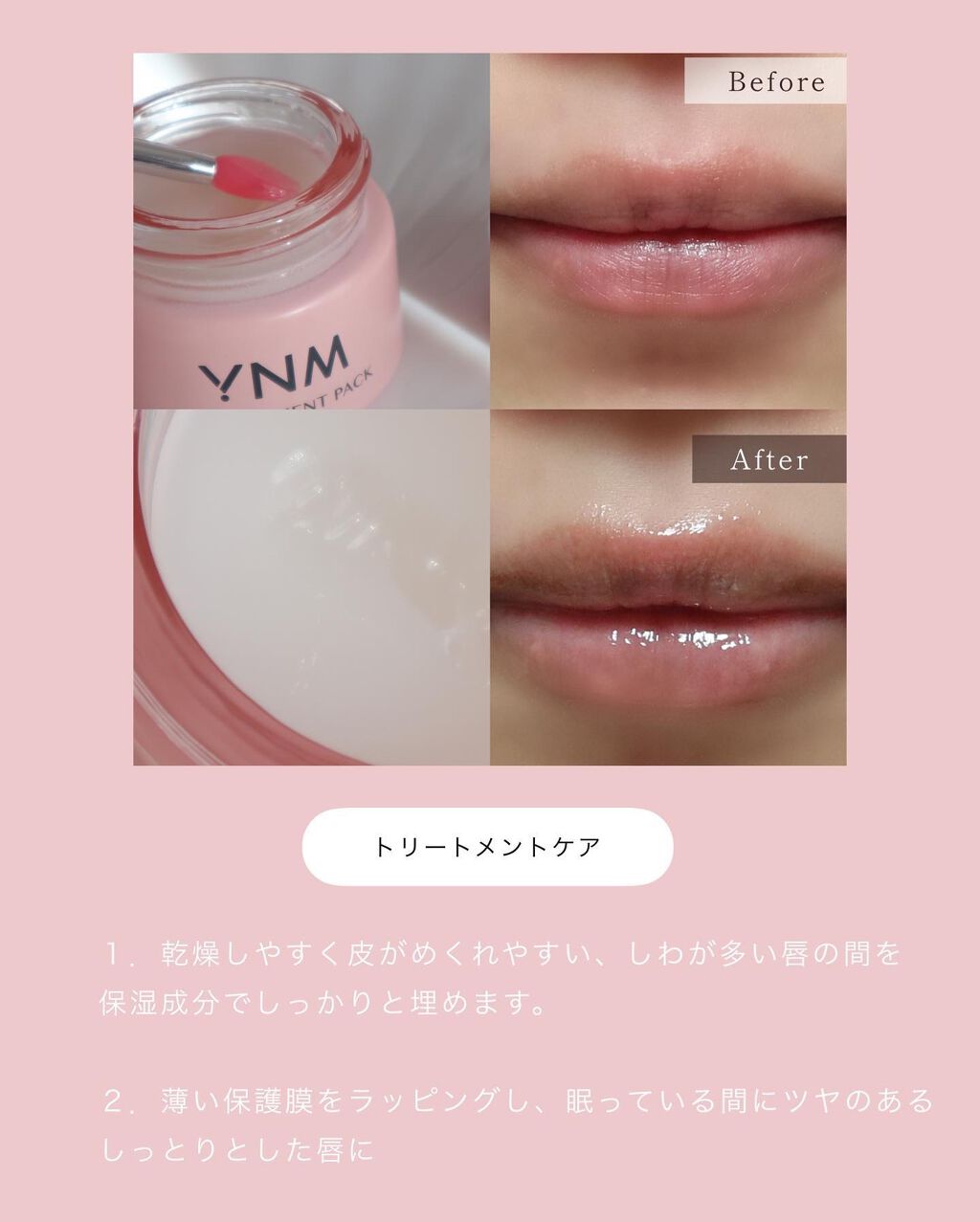 YNM リップトリートメントパック/YNM/リップマスクを使ったクチコミ(2枚目)