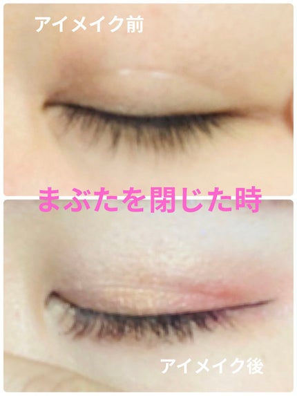 アイテープ片面(のびる)絆創膏タイプ スリム 120枚/セリア/二重まぶた用アイテムを使ったクチコミ(4枚目)