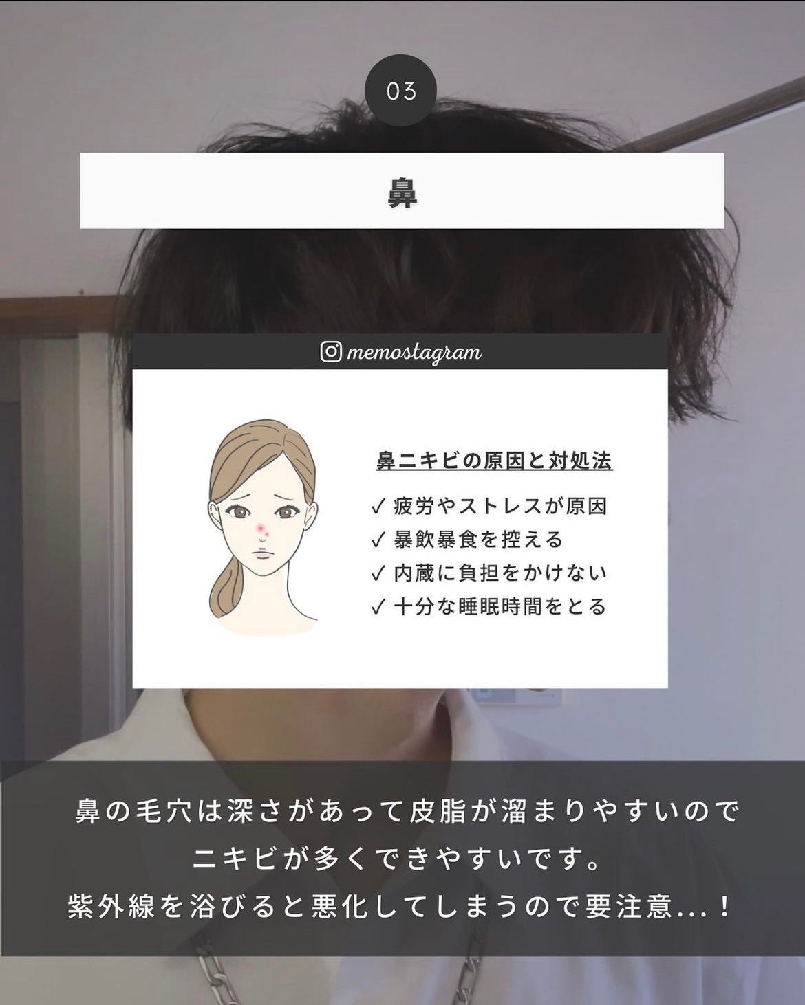 まえけん|ユニセックス美容 on LIPS 「【完全保存版!ニキビの原因7選】顔にニキビができた際に場所ごと..」(4枚目)