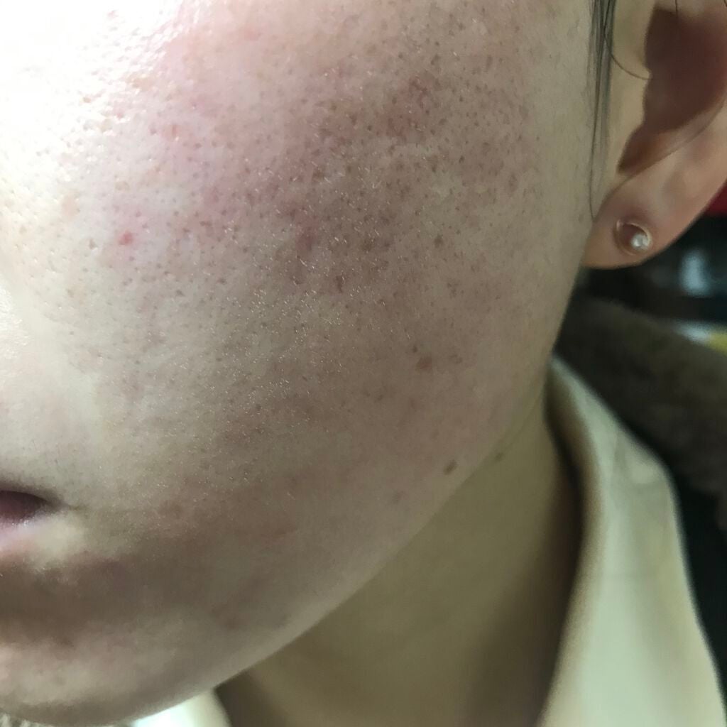 ビオオイル アルガンオイル/Melvita/フェイスオイルを使ったクチコミ(2枚目)