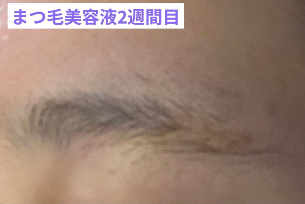スカルプD ボーテ ピュアフリーアイブロウセラム/アンファー(スカルプD)/その他アイブロウを使ったクチコミ(6枚目)