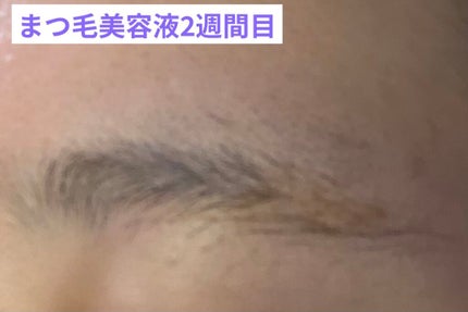 スカルプD ボーテ ピュアフリーアイブロウセラム/アンファー(スカルプD)/その他アイブロウを使ったクチコミ(6枚目)