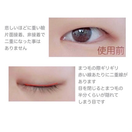 ハイブリッドフィルム/アイトーク/二重まぶた用アイテムを使ったクチコミ(8枚目)