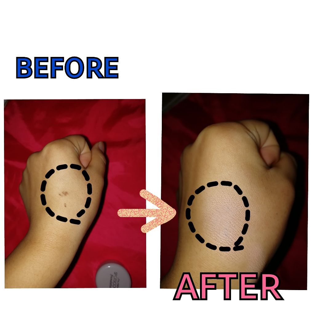 スポッツカバー ファウンデイション/SHISEIDO/クリームコンシーラーを使ったクチコミ(2枚目)