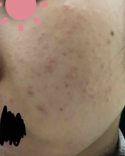 敏感肌用薬用美白美容液/無印良品/美容液を使ったクチコミ(3枚目)