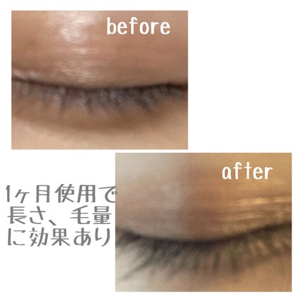 ラッシュアディクト アイラッシュコンディショニングセラム/soaddicted/まつげ美容液を使ったクチコミ(2枚目)