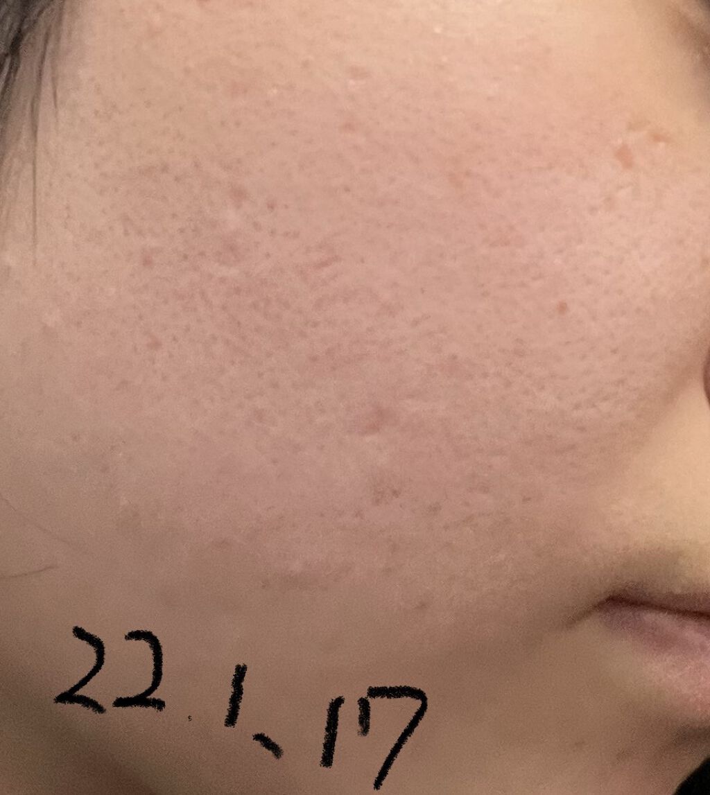 クリアウォッシュ/オルビス/洗顔フォームを使ったクチコミ（3枚目）