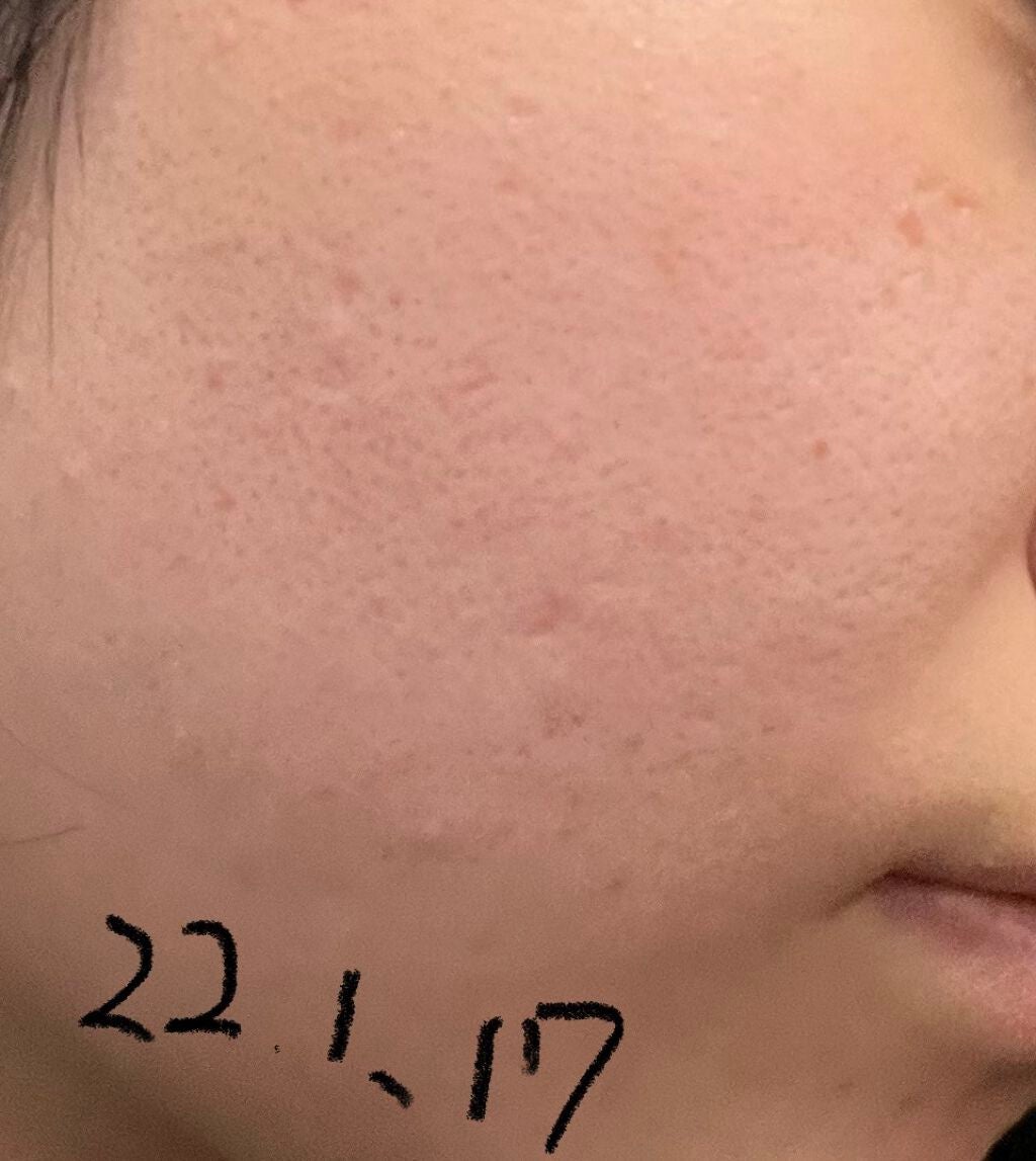 クリアウォッシュ/オルビス/洗顔フォームを使ったクチコミ(3枚目)