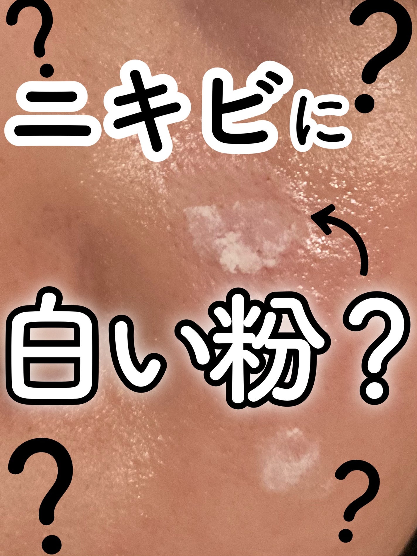 1番 かけるパントテン酸スキンパウダー/numbuzin/その他スキンケアを使ったクチコミ(1枚目)